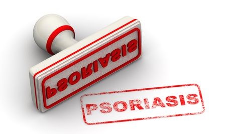 Псориаз (psoriasis). Печать и оттиск